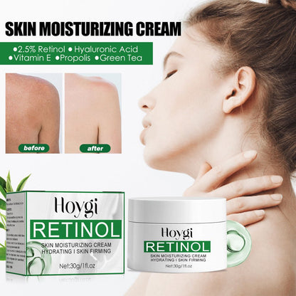 Hoygi Retinol Moisturizer