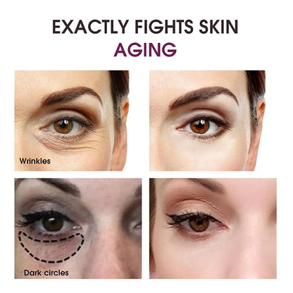 Professional title: Advanced Brightening Eye Cream with Retinol, Hyaluronic Acid, and Dark Circle Reduction for Undereye Lightening